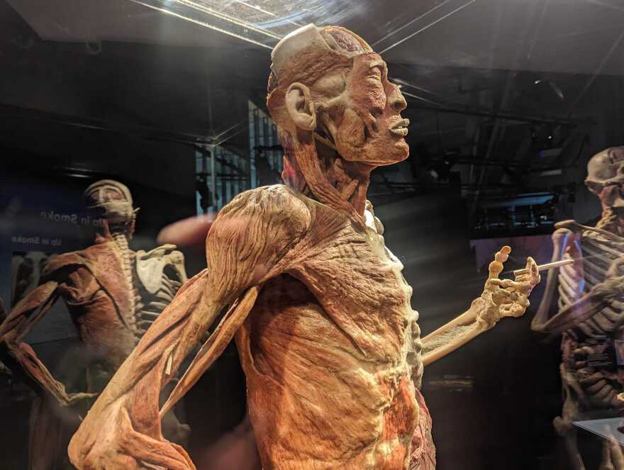 BodyWorldsTheSmokerSideView.jpg