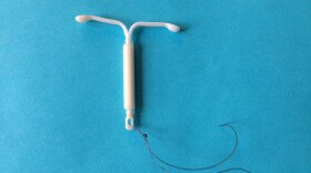 iud.jpg