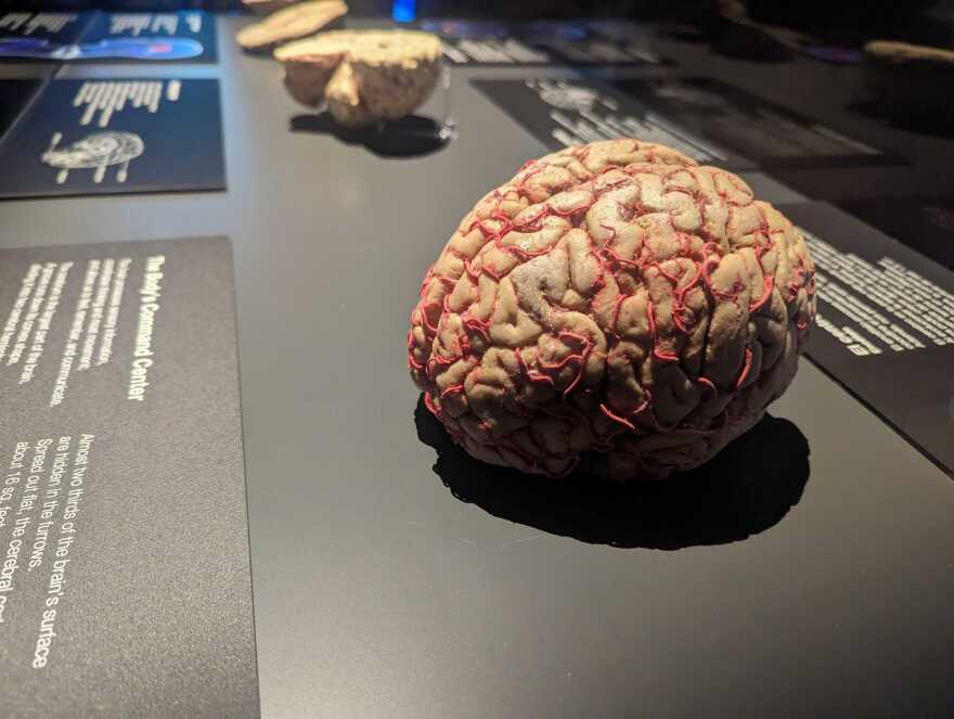 BodyWorldsBrain.jpg