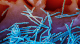 RSV Vaccines