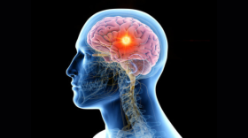 Mind Your Brain