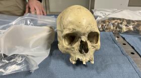 Skull.jpg