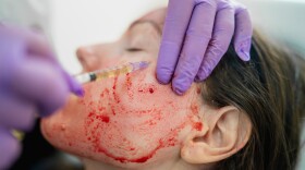 Revolutionary treatment of rejuvenation with blood plasma