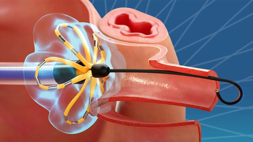Ablation tool