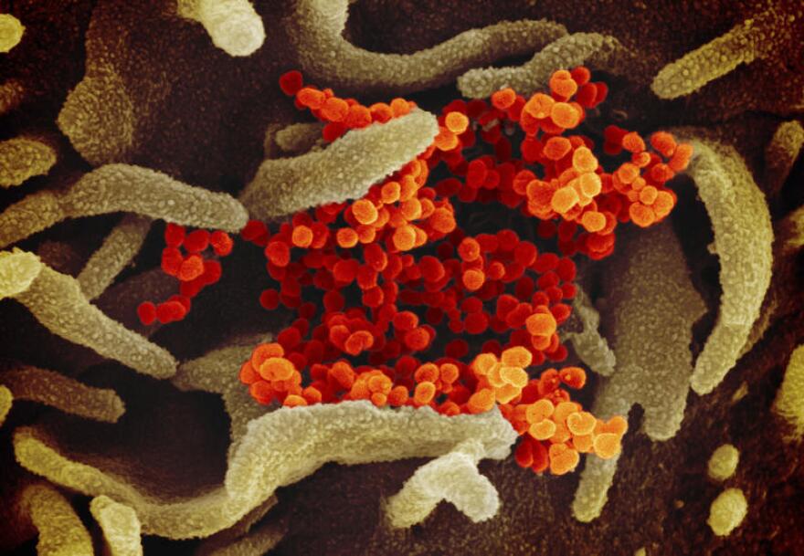 China-Outbreak-Q A